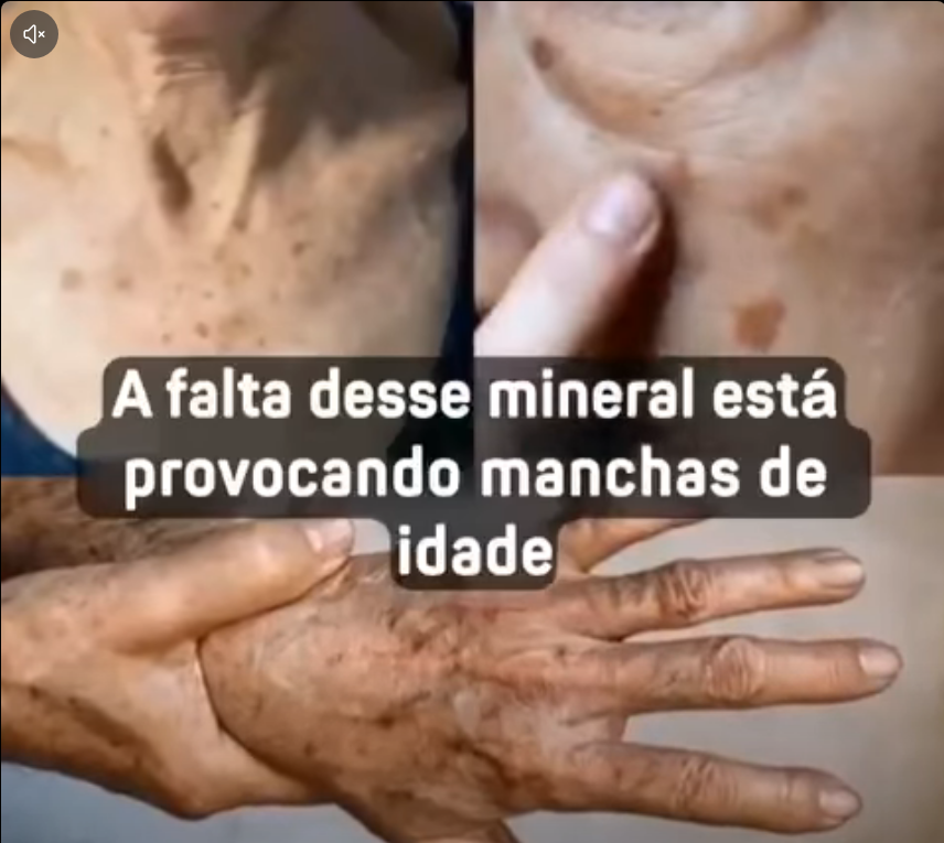 Selênio