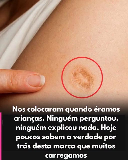 Marca redonda no braço: descubra o que significa
